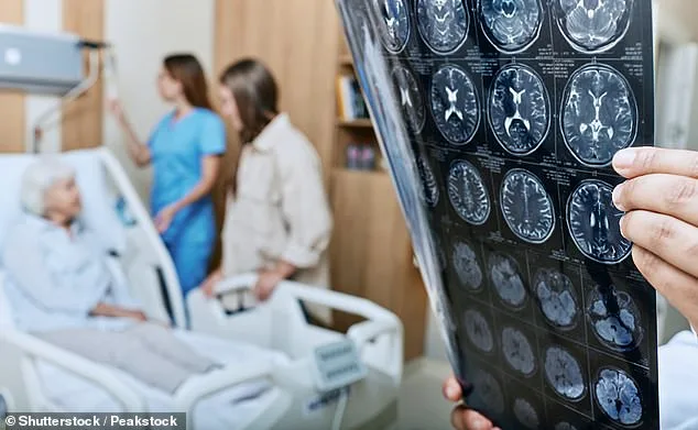 Gut Microbiome Found to Transfer Alzheimer's Symptoms in Groundbreaking Study