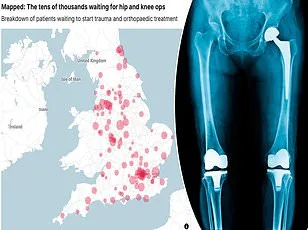 Innovative Smart Shoes from University of Bristol Target NHS's £2.3 Billion Falls Crisis