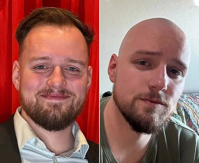 r/bald: A Supportive Subreddit Uplifting Balding Men with Positivity and Transformation