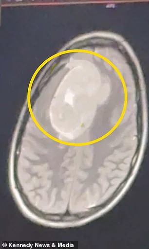 When Doctors Dismissed Her Pain: A 21-Year-Old's Relentless Fight Against a Devastating Illness