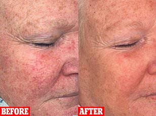 The Overlooked Struggle: Society's Dismissal of Skin-Related Illnesses