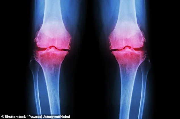 Columbia University Breakthrough: Lab-Grown Human Knee Offers New Hope for Osteoarthritis Patients