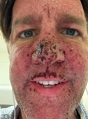 Ben Sasse's Experimental Cancer Treatment Amid 3% Survival Odds