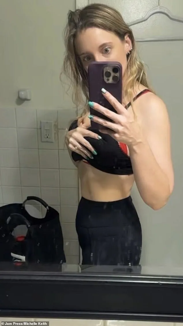 Michelle Keith's Fight Against Lipoedema: A Mother's Struggle with Unrelenting Fat and Pain