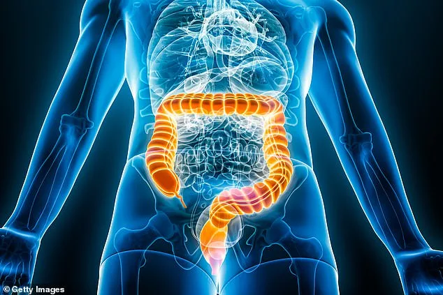 Bowel Cancer Surge in Young Britons: The Mystery Behind the Rising Rates