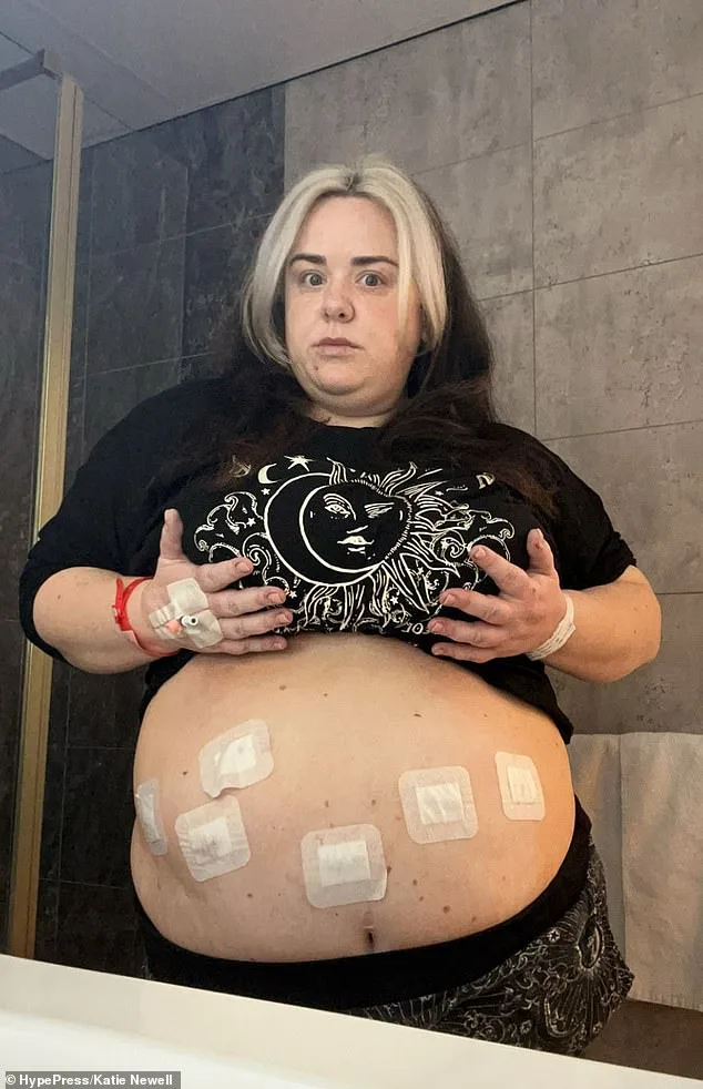 Katie Newell's Gastric Bypass Journey: Overcoming Obesity and Mental Health Challenges