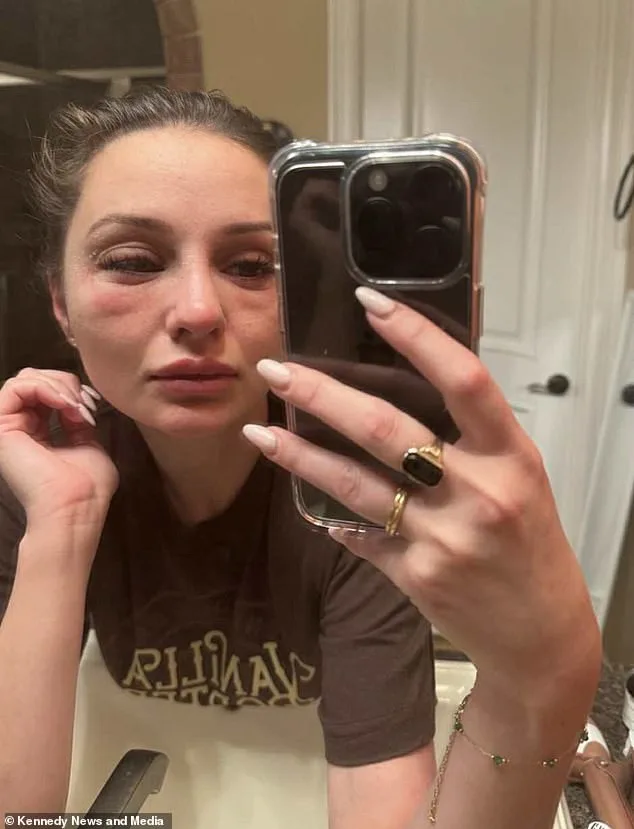 Toxic Mold Exposure Revealed as Silent Culprit Behind Hair Loss and Illness in Woman and Pet