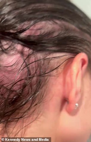 Toxic Mold Exposure Revealed as Silent Culprit Behind Hair Loss and Illness in Woman and Pet