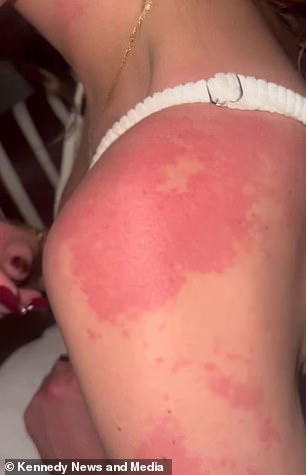 Toxic Mold Exposure Revealed as Silent Culprit Behind Hair Loss and Illness in Woman and Pet