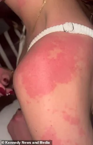 Toxic Mold Exposure Revealed as Silent Culprit Behind Hair Loss and Illness in Woman and Pet