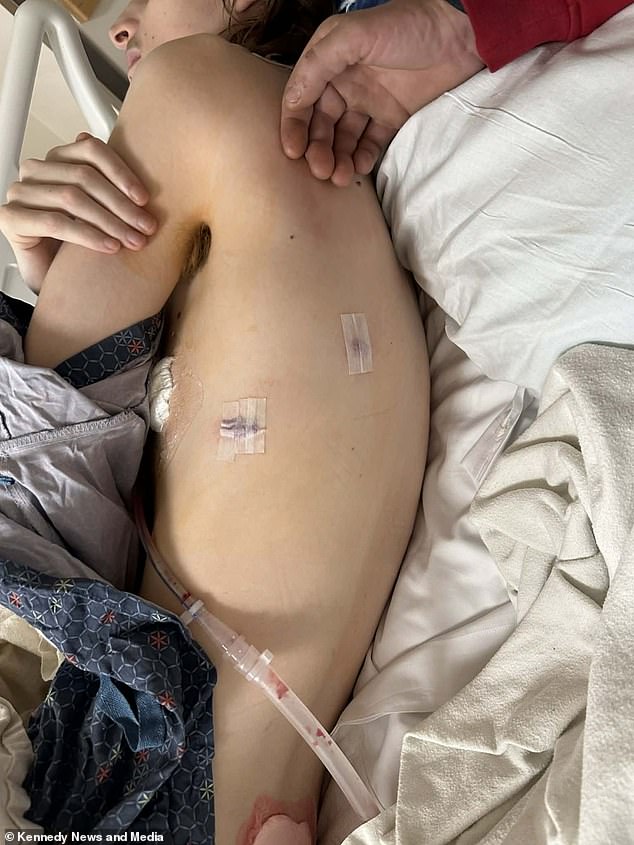 Kentucky Mother Issues Urgent Warning About Vaping After Son's Double Lung Collapse