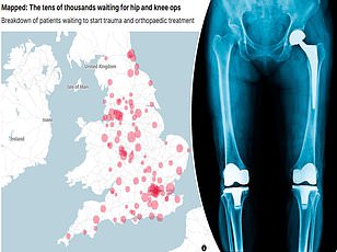Innovative Smart Shoes from University of Bristol Target NHS's £2.3 Billion Falls Crisis