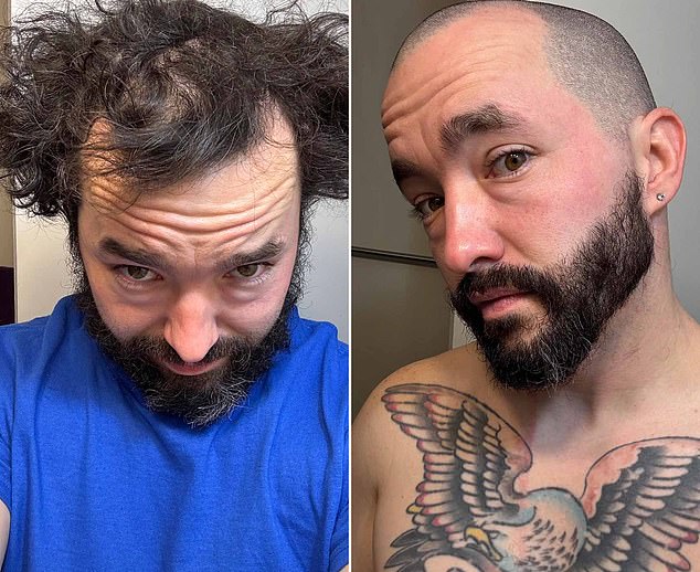 r/bald: A Supportive Subreddit Uplifting Balding Men with Positivity and Transformation