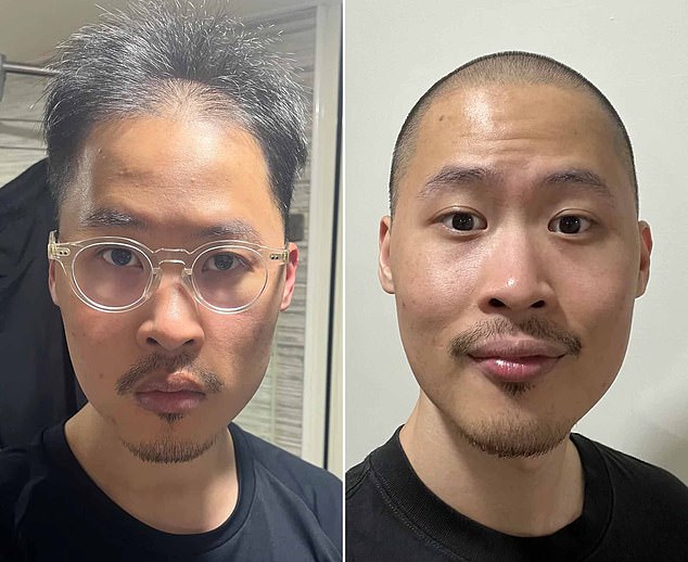 r/bald: A Supportive Subreddit Uplifting Balding Men with Positivity and Transformation
