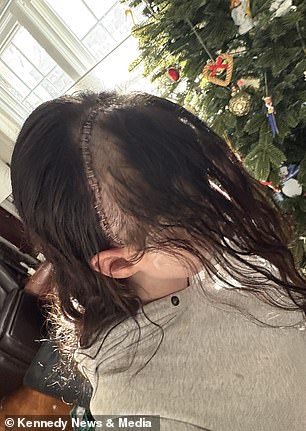 When Doctors Dismissed Her Pain: A 21-Year-Old's Relentless Fight Against a Devastating Illness