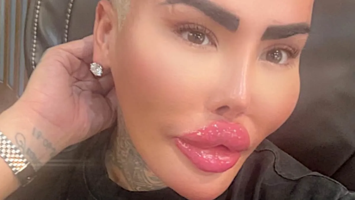 Two Arrested in Death of 'The Lip King' Jordan James Parke