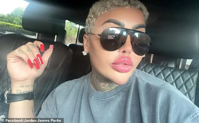 Two Arrested in Death of 'The Lip King' Jordan James Parke