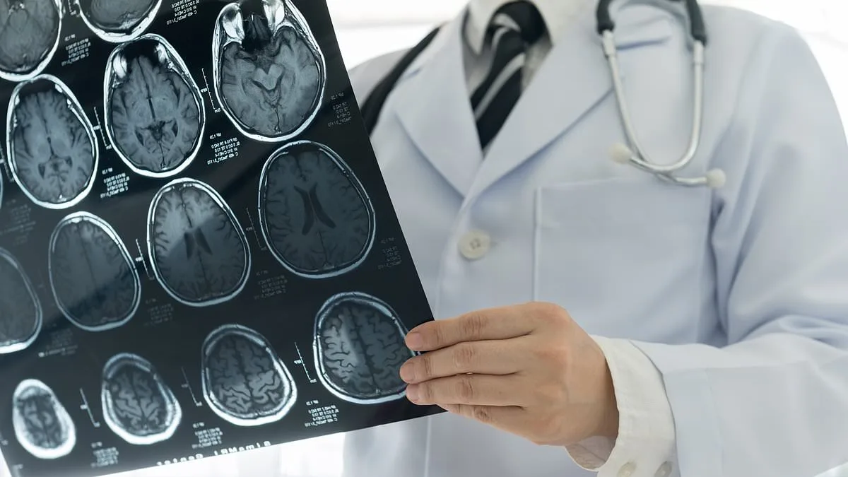 Gap in NHS Care for Aggressive Brain Tumour Patients Exacerbates UK's Poor Survival Rates