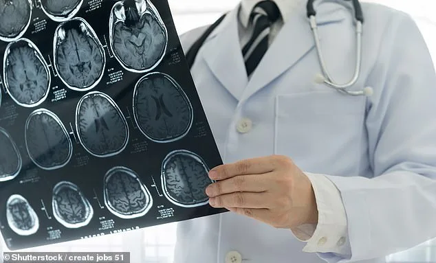 Gap in NHS Care for Aggressive Brain Tumour Patients Exacerbates UK's Poor Survival Rates