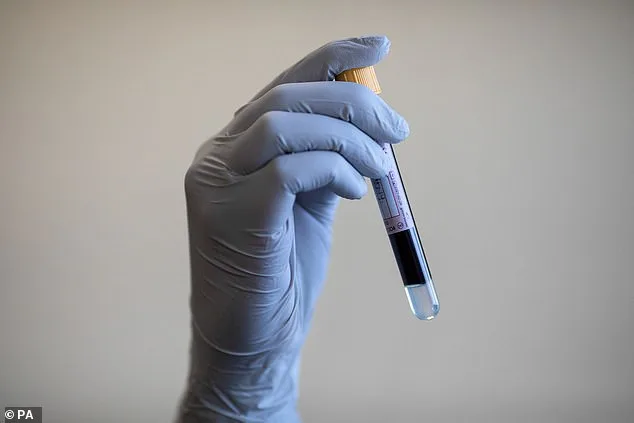 Gap in NHS Care for Aggressive Brain Tumour Patients Exacerbates UK's Poor Survival Rates