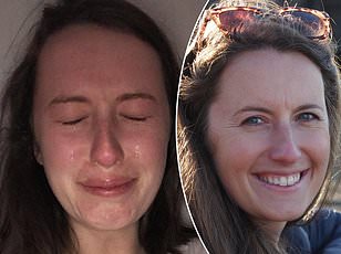 Double Vision: A Critical Red Flag for Stroke, Brain Tumors, and Other Neurological Emergencies