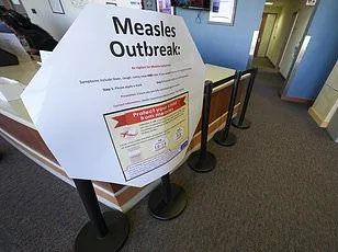 Measles' Terrifying Resurgence: Hidden Brain Damage Lurks Decades Later