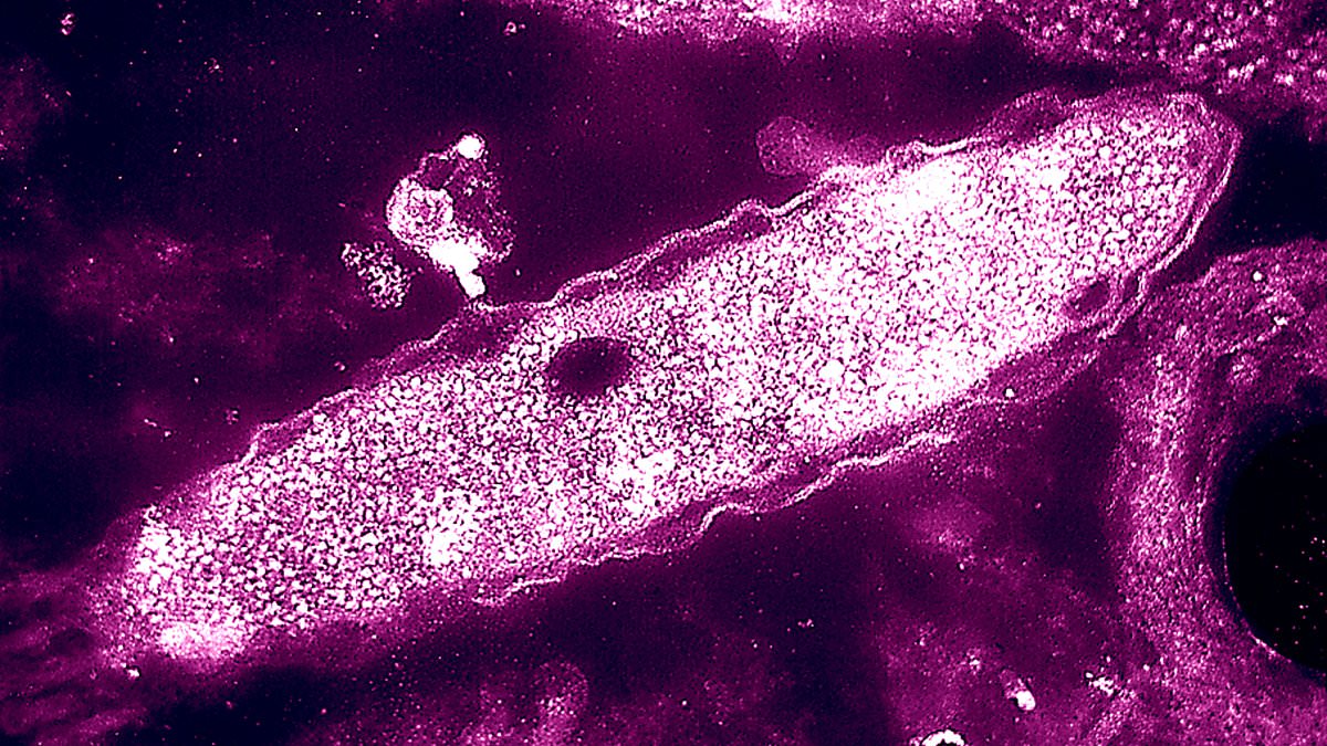 UKHSA Investigates Legionella Outbreak Fueling Legionnaires' Disease Surge in London