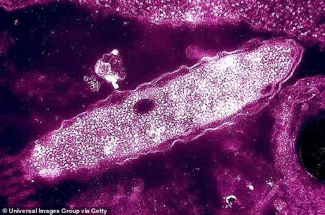 UKHSA Investigates Legionella Outbreak Fueling Legionnaires' Disease Surge in London