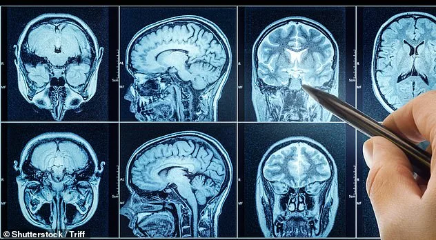 Declassified CIA Document Links Cold War-Era Soviet Research to Modern Cancer Drug Mebendazole, Raising Questions About Suppressed Discoveries