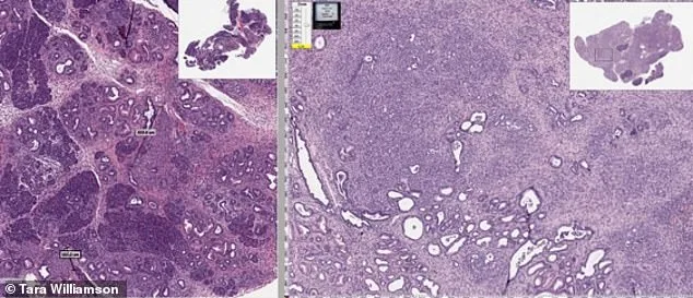 Declassified CIA Document Links Cold War-Era Soviet Research to Modern Cancer Drug Mebendazole, Raising Questions About Suppressed Discoveries