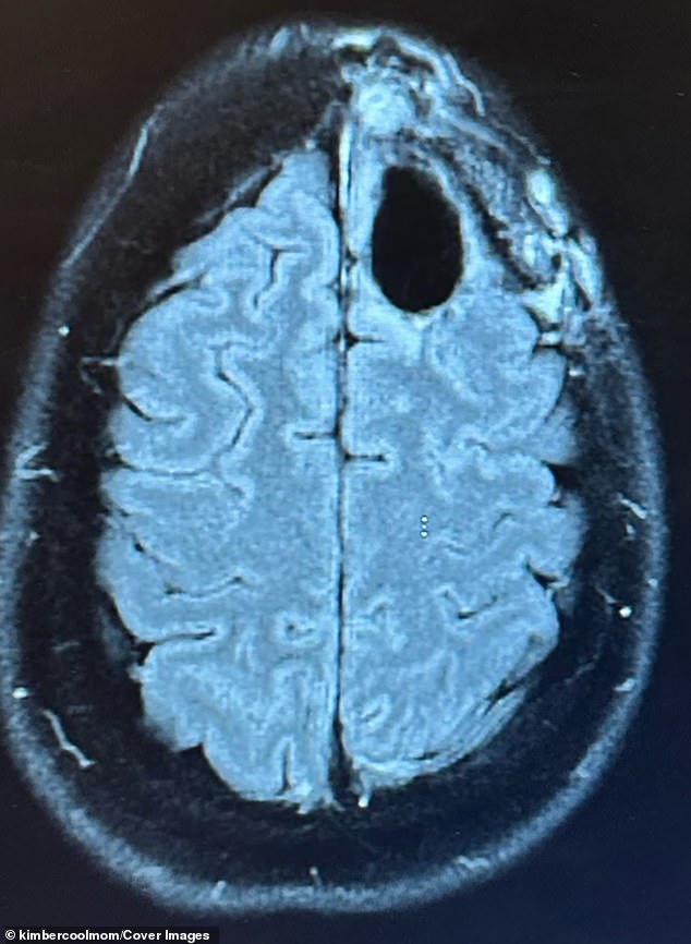 Kimberly Pelling's Resilient Battle: Surviving a Terminal Brain Tumor as a New Mother