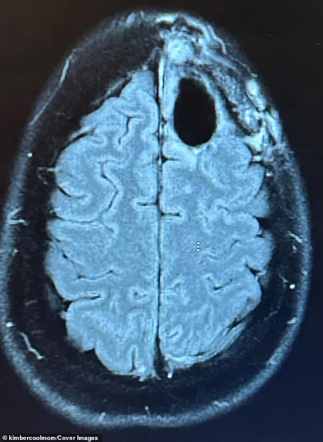 Kimberly Pelling's Resilient Battle: Surviving a Terminal Brain Tumor as a New Mother