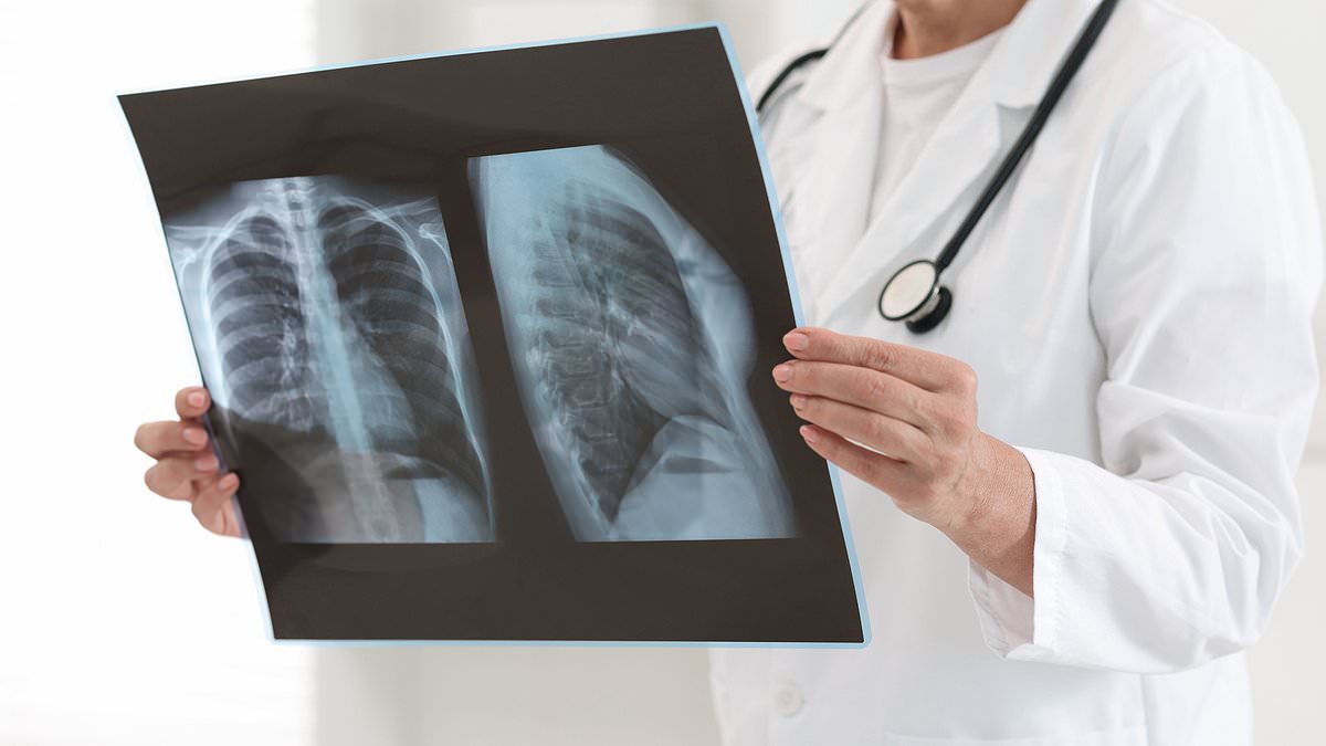 Study Reveals Severe Viral Infections May Reprogram Lungs, Elevating Lung Cancer Risk Years Later