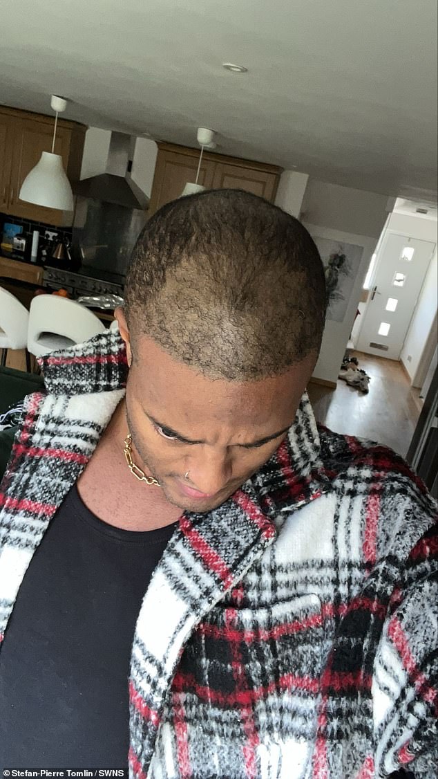 From Wigs to Transplants: The Secret Life of Tinder's Most Right-Swiped Man