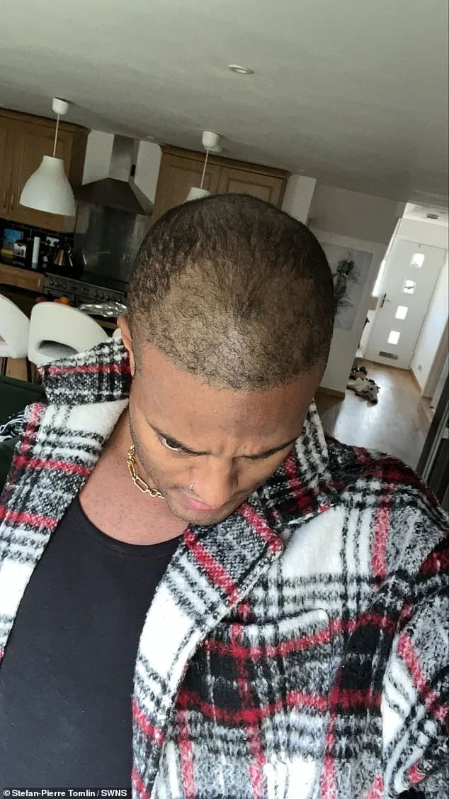 From Wigs to Transplants: The Secret Life of Tinder's Most Right-Swiped Man