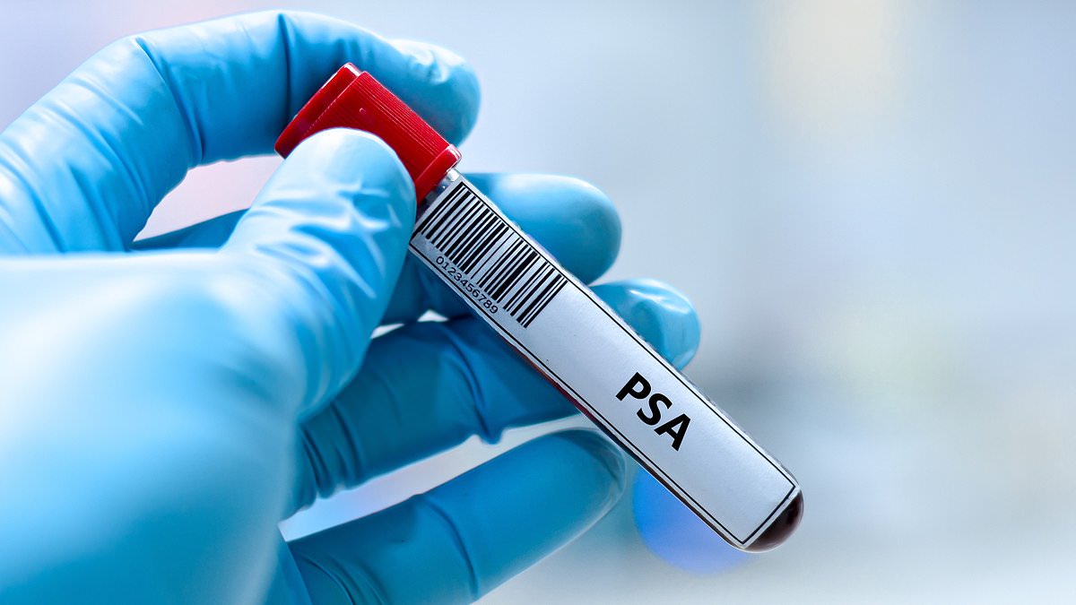 Landmark Study Challenges UK Prostate Screening Policies, Claims Blood Tests Match Breast Cancer Program's Efficacy