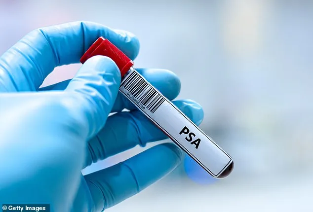 Landmark Study Challenges UK Prostate Screening Policies, Claims Blood Tests Match Breast Cancer Program's Efficacy