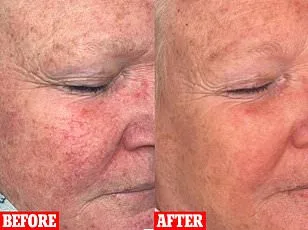 The Overlooked Struggle: Society's Dismissal of Skin-Related Illnesses