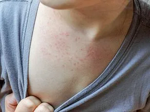 Surge in Little-Known Respiratory Virus HMPV Sparks Public Health Alarms as Cases Rise Sharply