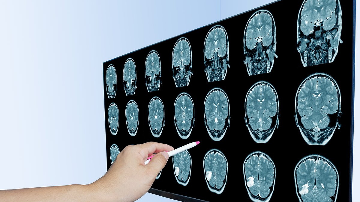 The Silent Epidemic: How Chronic Inflammation is Undermining Global Health