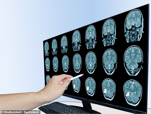 The Silent Epidemic: How Chronic Inflammation is Undermining Global Health