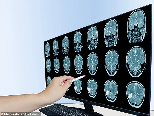 The Silent Epidemic: How Chronic Inflammation is Undermining Global Health