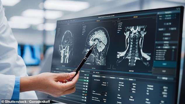 When Headaches Signal Life-Threatening Conditions: Recognizing the Four Red Flags That Demand Immediate Attention