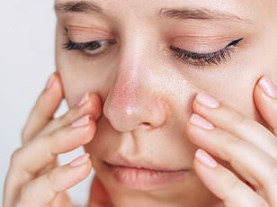 The Hidden Cost of Weight Loss Breakthroughs: Nausea, Hair Loss, and the Body's Price for Shedding Pounds