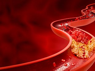 Small Lifestyle Changes Can Cut Heart Attack Risk by 57%: Study Reveals Power of Incremental Adjustments