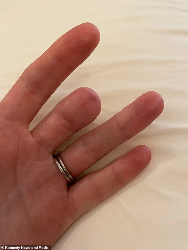 A Faint Brown Line Under the Nail: A Warning Sign of Deadly Cancer