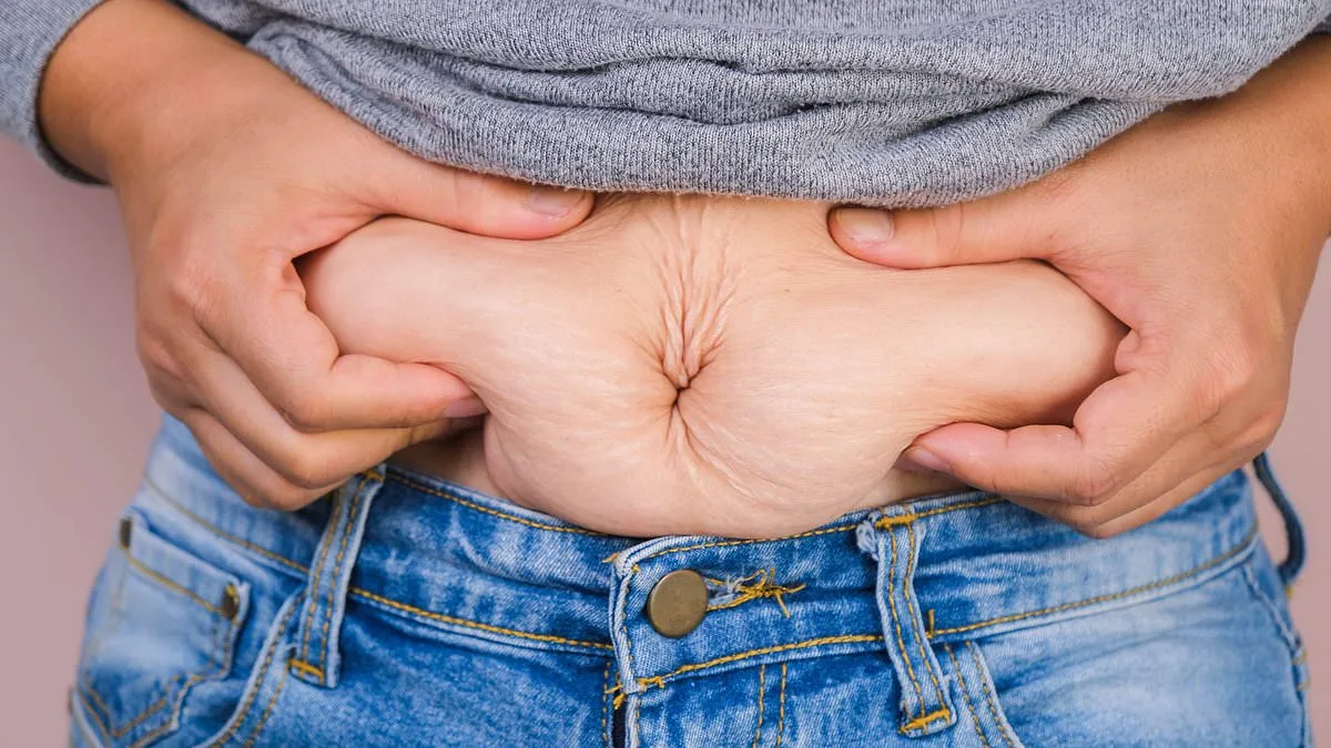 Obesity Linked to More Cancer Cases Than Previously Thought, Study Finds; Second Leading Cause After Smoking