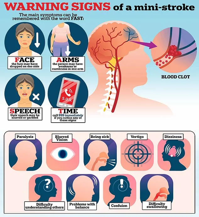 Mini Strokes: The Silent Alarm That Could Save Your Life