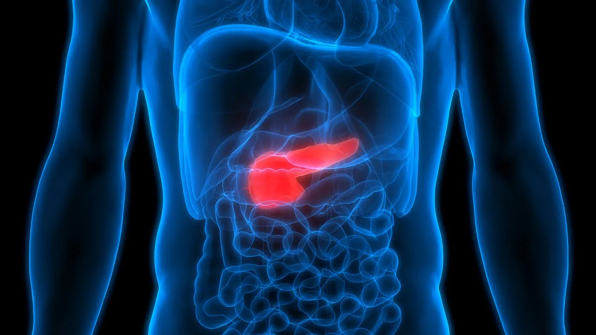 The Silent Killer: Pancreatic Cancer's Deadly Elusiveness and the Challenge of Survival