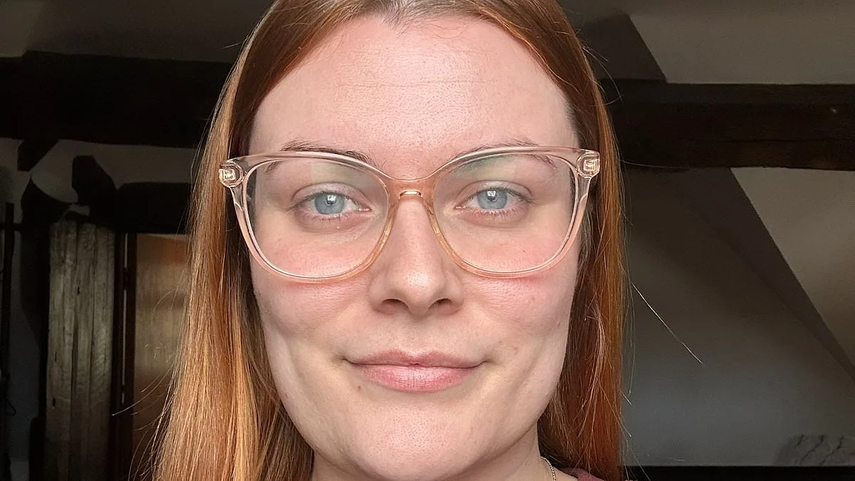 The Daily Struggle of Hirsutism: A Young Woman's Journey with PCOS